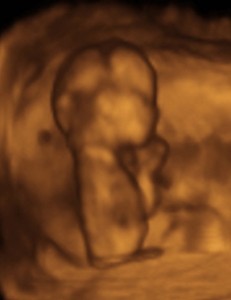 Ultrasound baby